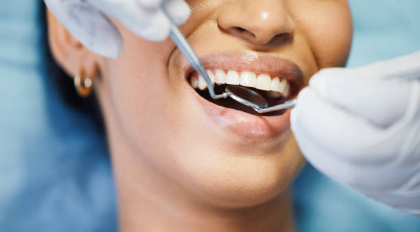 Fast & Reliable Emergency Dental Services in SD